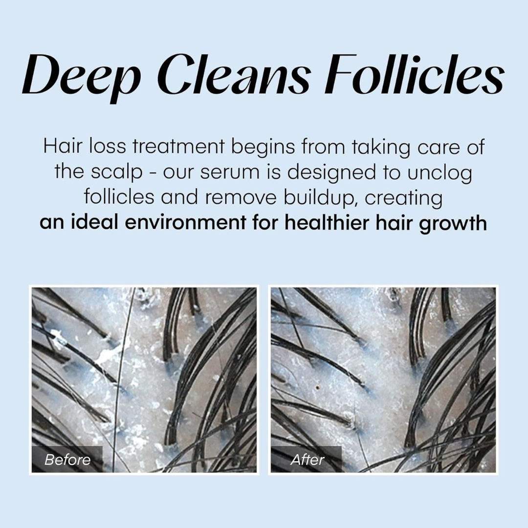 Scalpy Hair Serum – Advanced Hair Growth & Scalp Nourishing Formula