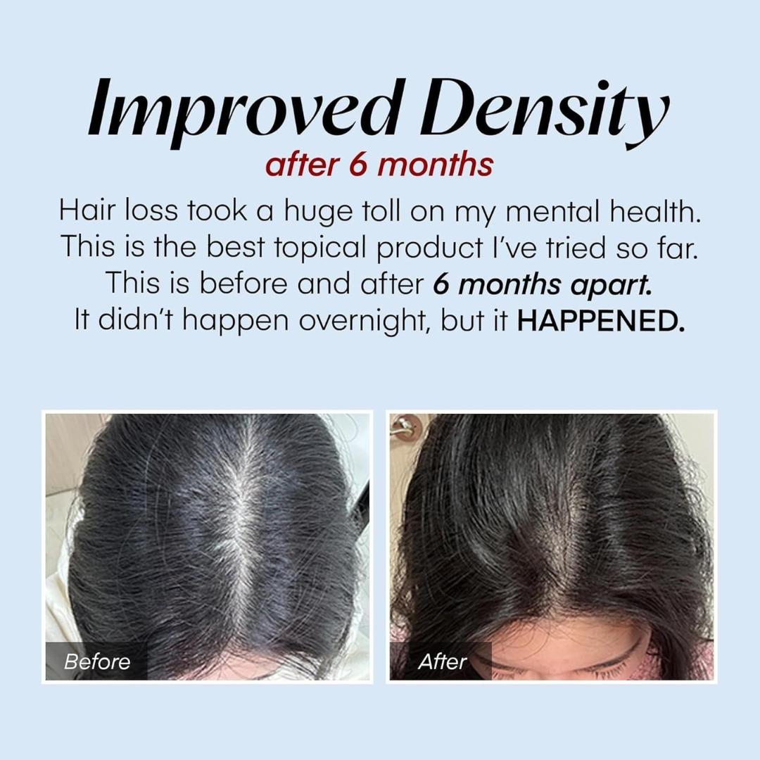 Scalpy Hair Serum – Advanced Hair Growth & Scalp Nourishing Formula